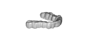 Bite Splint